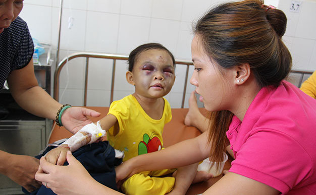 Bé Đỗ Thị Kim Ngân đang được hàng xóm chăm sóc tại Bệnh viện Đa khoa tỉnh Bình Dương - Ảnh: Bá Sơn