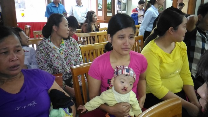 phau thuat tu thien di tat vung mat cho tre em co hoan canh kho khan