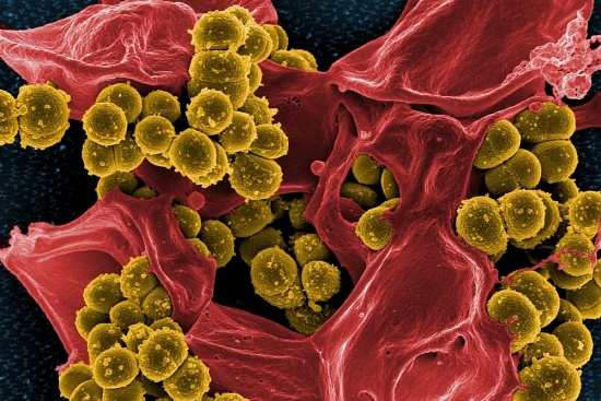 Giới khoa học cảnh báo về siêu vi khuẩn kháng kháng sinh từ lợn lây sang người