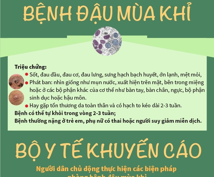 Chủ động biện pháp ứng phó dịch bệnh đậu mùa khỉ