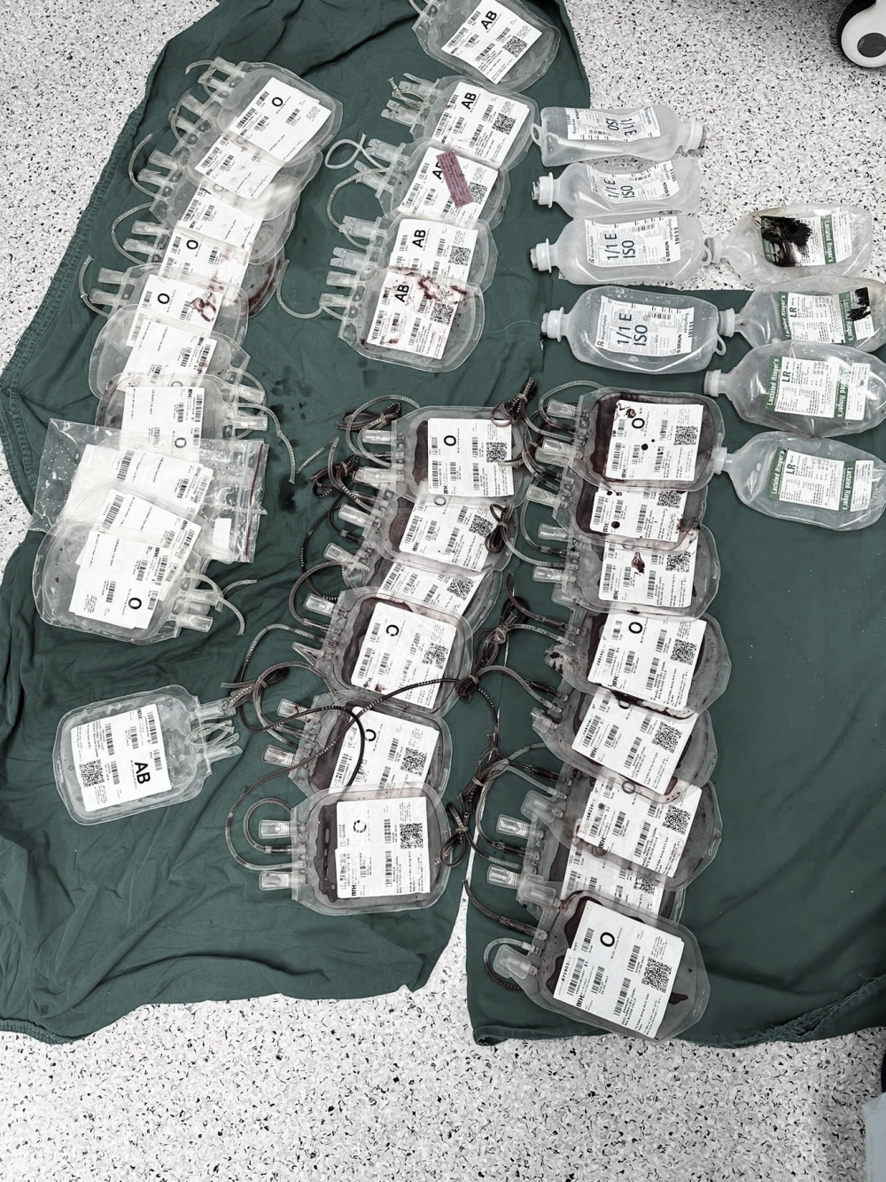 TP.HCM: Truyền 18 túi hồng cầu cứu sống bệnh nhi bị xe tải cán ngang bụng