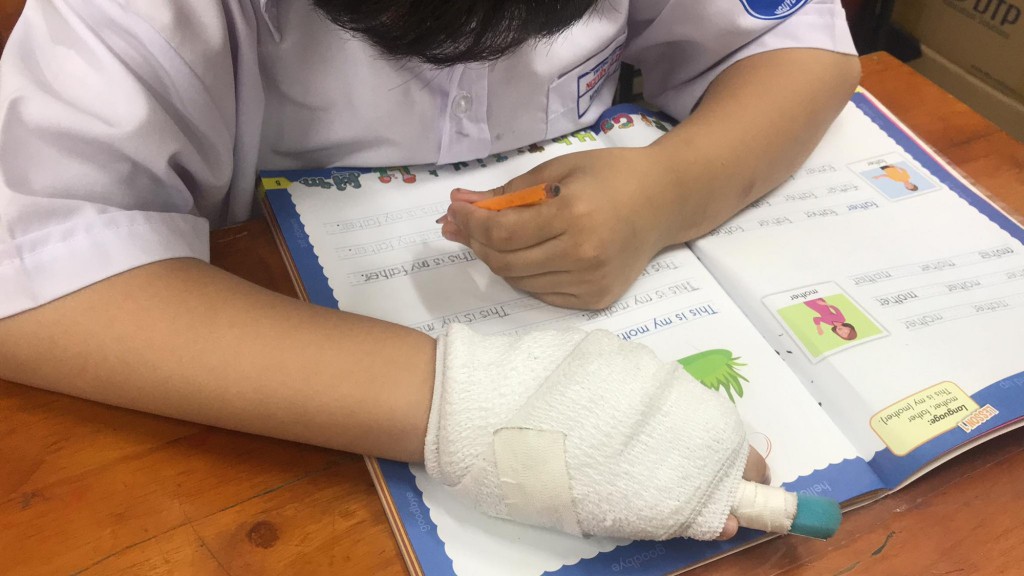 TP.HCM: Cảnh cáo cô giáo đánh gãy ngón tay học sinh