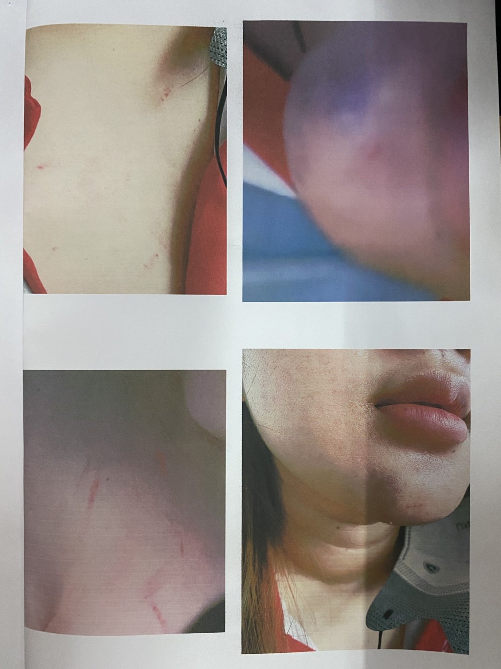 Vụ nữ sinh lớp 12 bị phụ huynh đánh gây thương tích: Trường THPT Sài Gòn lên tiếng