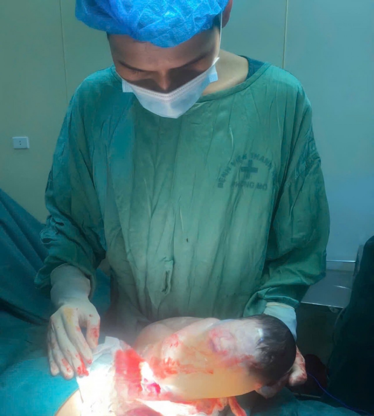 Bé sơ sinh chào đời còn nguyên trong bọc ối vô cùng hiếm gặp