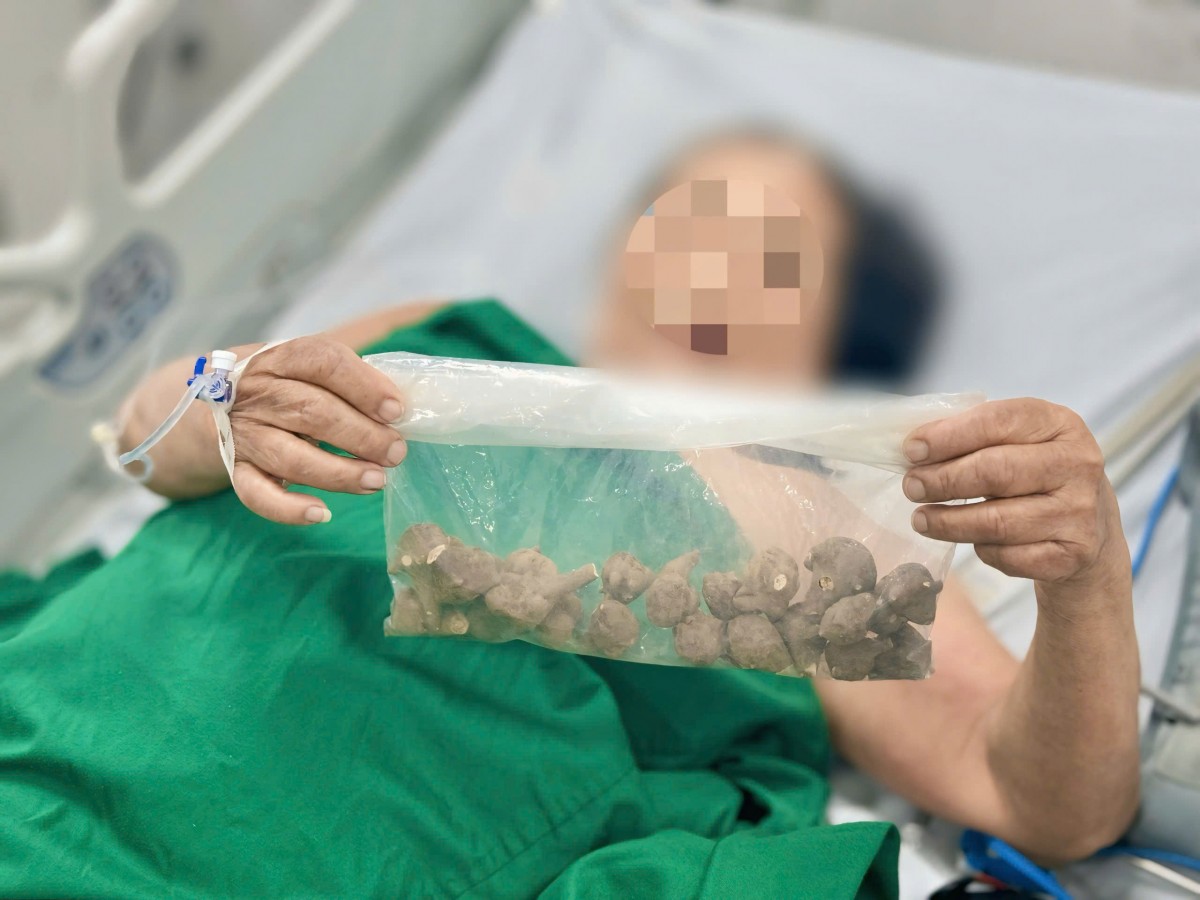 Bệnh nhân ngộ độc nguy kịch do uống củ ấu tầu chưa qua chế biến Bệnh nhân ngộ độc nguy kịch do uống củ ấu tầu chưa qua chế biến