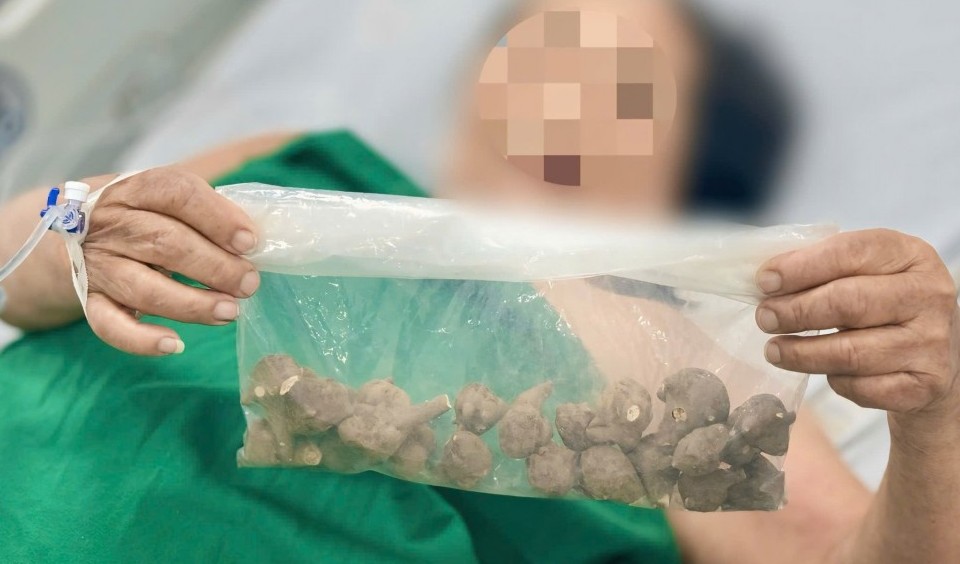 Bệnh nhân ngộ độc nguy kịch do uống củ ấu tầu chưa qua chế biến