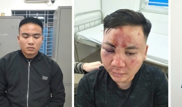 Nghệ An: Tạm giữ 10 đối tượng trong vụ tấn công, đập phá ô tô ngày khai trương