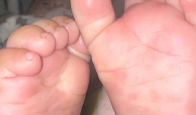 Khi xét nghiệm của bố mẹ cứu con khỏi căn bệnh thầm lặng