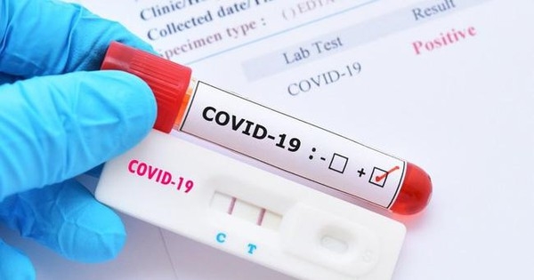 Bộ Công Thương khuyến cáo không nên mua kit test nhanh kháng nguyên SARS-CoV-2 trôi nổi