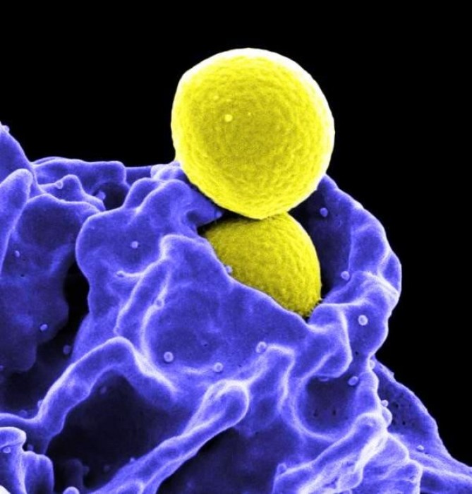 Bảy vi khuẩn gây bệnh “cứng đầu” kháng thuốc