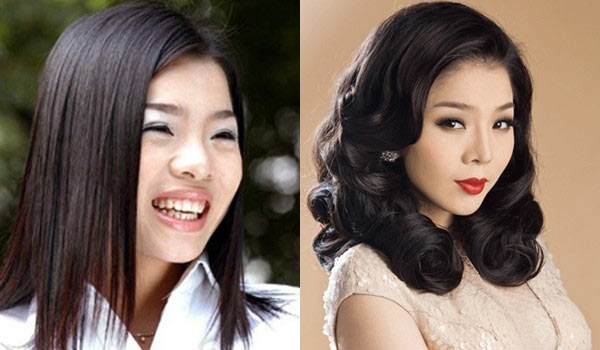 10 sao Việt thừa nhận phẫu thuật thẩm mỹ 2-6145-1403696511.jpg