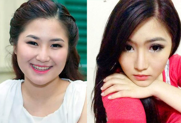 10 sao Việt thừa nhận phẫu thuật thẩm mỹ 9-1840-1403696510.jpg