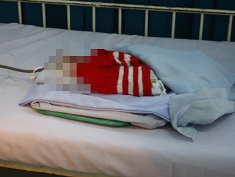 Bác sĩ chẩn đoán nhầm, suýt chôn sống con Bác sĩ chẩn đoán nhầm, suýt chôn sống con