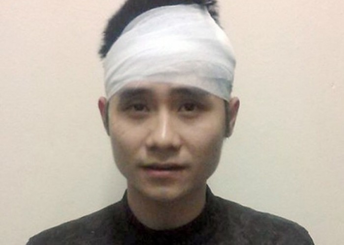 Đâm trọng thương 3 người chỉ vì va chạm nhỏ