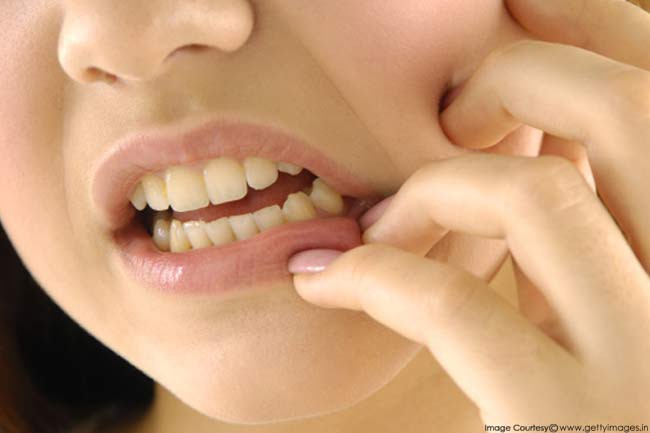 Những nguyên nhân phổ biến gây các vấn đề về răng miệng