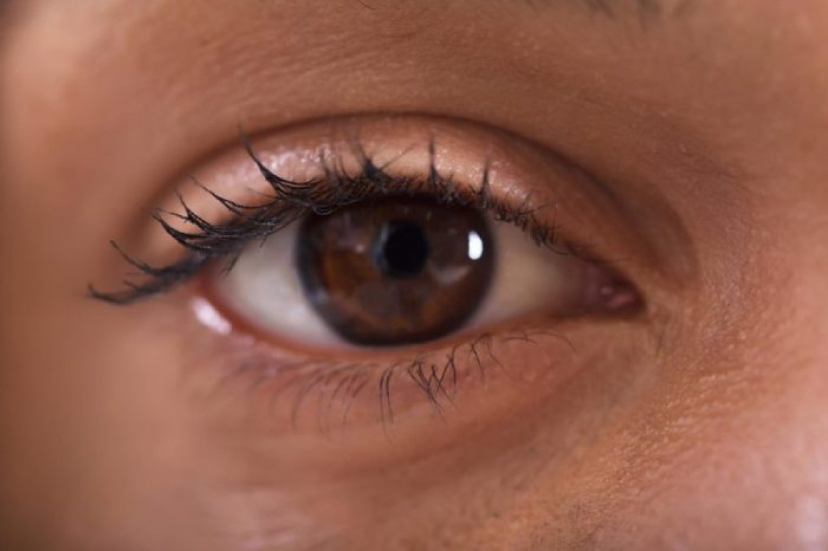 Gỉ mắt không trong suốt: Gỉ mắt không trong suốt mà có màu vàng, xanh hoặc trắng đục có thể là dấu hiệu của một dạng nhiễm khuẩn mắt, ví dụ như đau mắt đỏ. Trong trường hợp này, bạn có thể thấy mắt ngứa ngáy và có màu đỏ máu.
