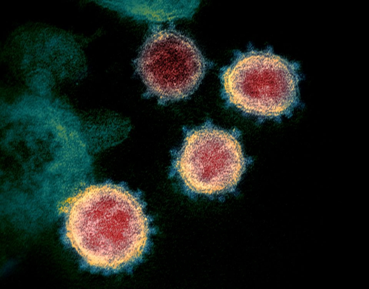 Virus SARS-CoV-2 qua kính hiển vi. Nguồn: NIAID-RML/Handout/REUTERS.