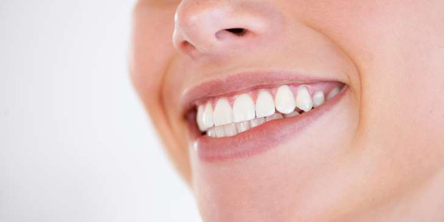 8 điểm cần lưu ý trước khi làm trắng răng