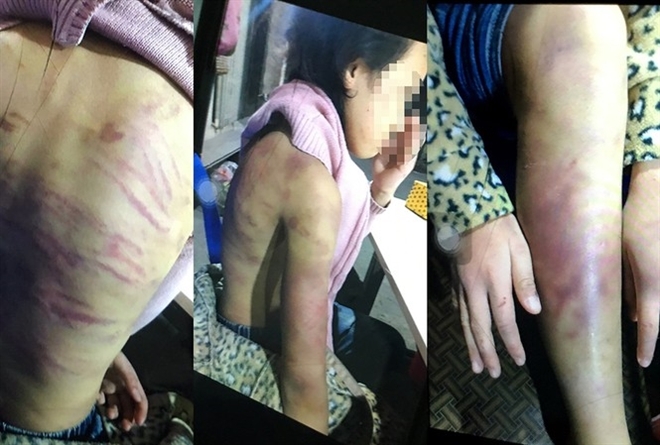Vụ bé gái 12 tuổi bị bạo hành, xâm hại: Khởi tố mẹ đẻ và người tình