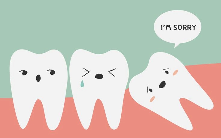 Infographics: Những điều bạn nên biết về răng khôn