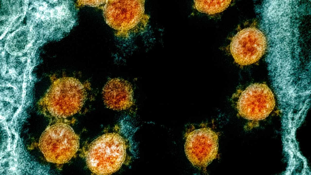 Vì sao biến chủng của virus SARS-CoV-2 xuất hiện ngày càng nhiều và nguy hiểm hơn?
