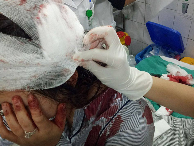 Hà Nội: Nữ sinh bị đánh gãy tay ngay tại cổng trường