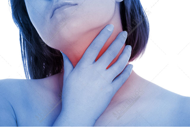 Viêm họng mãn – biến chứng từ trào ngược dạ dày thực quản