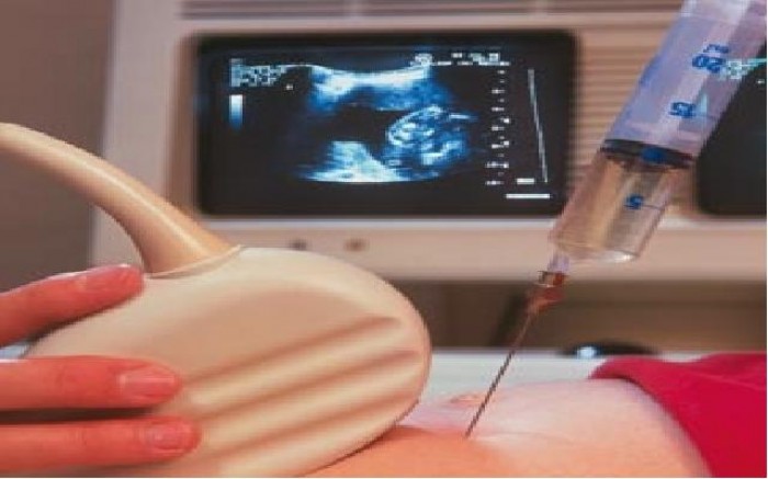 Có nên xét nghiệm sàng lọc trước sinh?