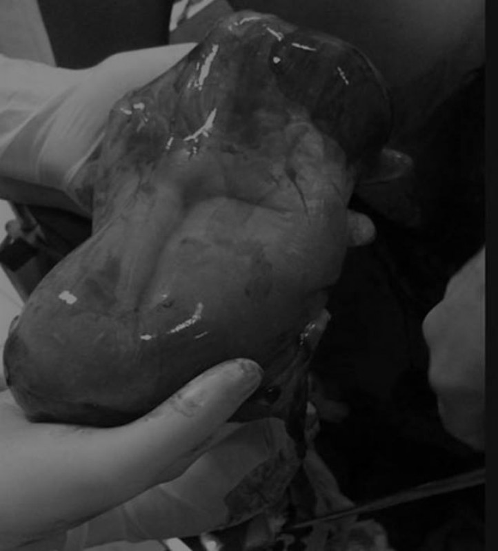 san phu sinh con van con nguyen trong boc oi